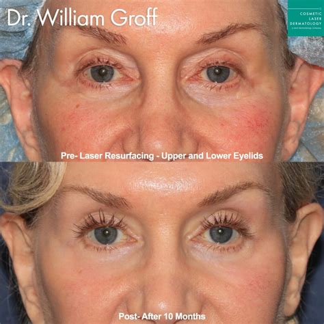 skin texture dermatology treatments san diego ca clderm