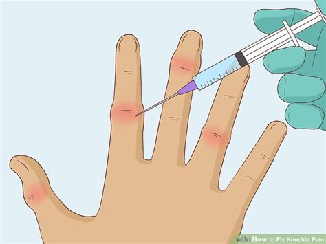 how to fix broken knuckle