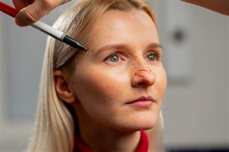 The Recovery Process After Rhinoplasty: What You Need to Know - Adnova