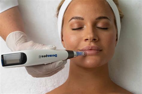 dermapen  mezoterapia mikroiglowa bielecka clinic