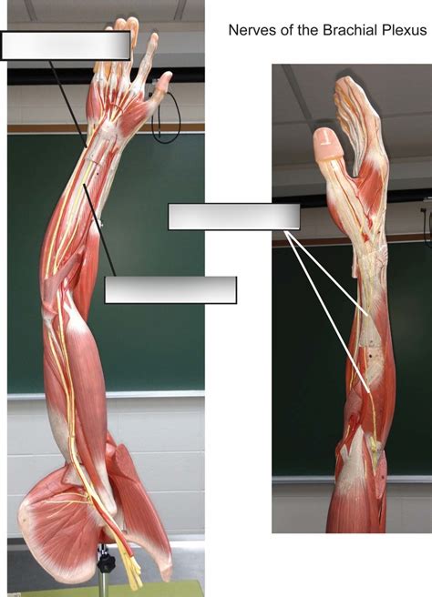 Upper Limb Nerves Diagram | Quizlet