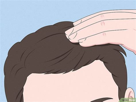 How to Tell if Your Hairline is Receding: Signs & Treatment