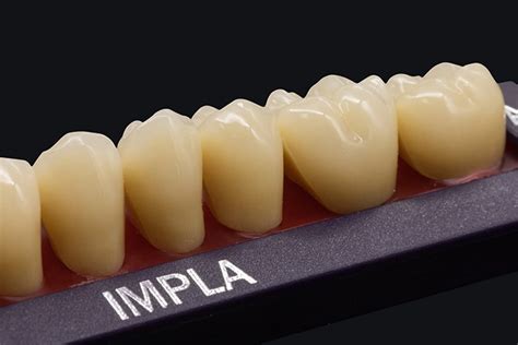 IMPLA Artificial Denture Teeth Material | HUGE Dental