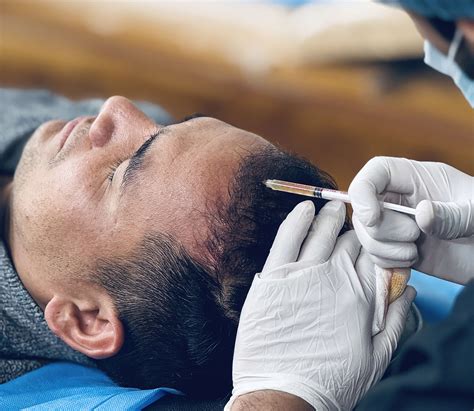 Best PRP Treatment in India: Hair Restoration & Skin Rejuvenation