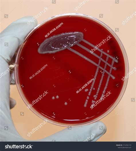 1 Blood Agar Shows Gamma Hemolysis Royalty-Free Images, Stock Photos