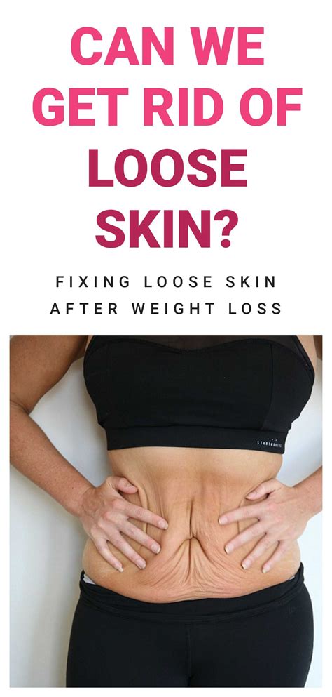No Loose Skin After Weight Loss
