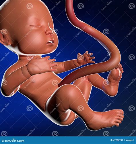 Umbilical Cord Hernia In A Newborn Stock Photo | CartoonDealer.com
