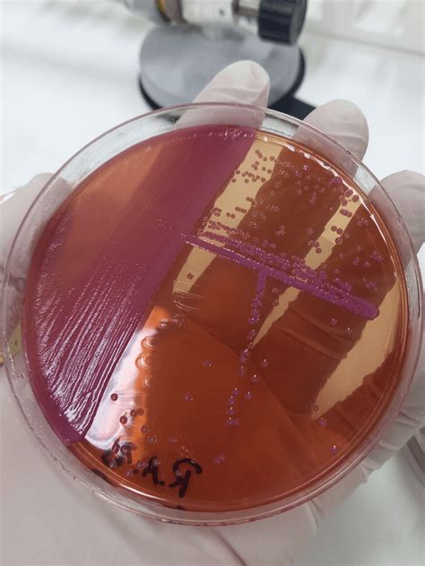 Klebsiella oxytoca : r/microbiology