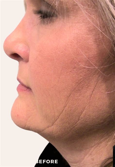 Facial Balancing - Serene Advanced Skin Care