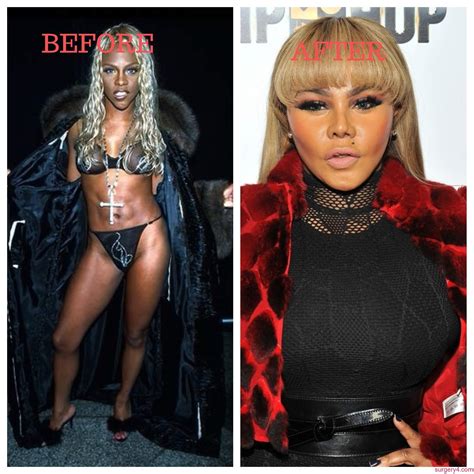 Lil Kim Plastic Surgery Photos [Before & After] - Surgery4