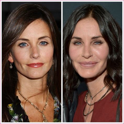 Phun Forum Celebrity Extra: The Truth About Celebrity Plastic Surgery! - jsal8sr