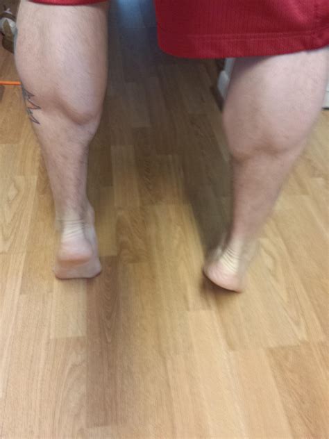 What is up with my calves? : r/Fitness