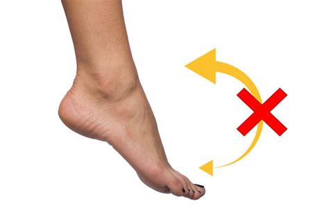 Foot Drop | Signs, Symptoms, Treatment | Straits Podiatry