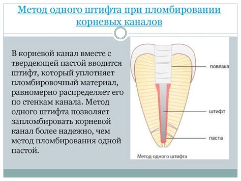 Штифты. Стоматология - презентация онлайн