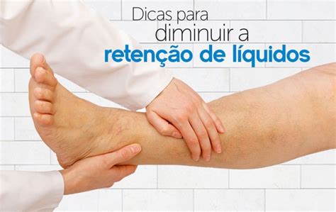 Como Saber Se Tem Retenção De Liquido - Retenção de liquido: como ocorre? como evitar?