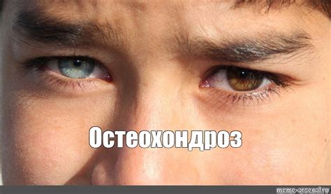 Создать мем "разные глаза, глаза гетерохромия, heterochromia iridis ...