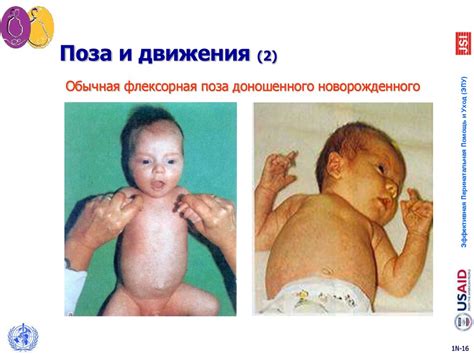 Полный осмотр новорожденного - презентация онлайн