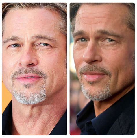 The Rise and Rise of Lip Fillers for Men | Glowday