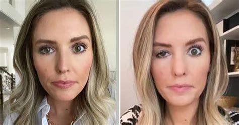 25 Celebrities Who Botched Their Looks With Plastic S - vrogue.co
