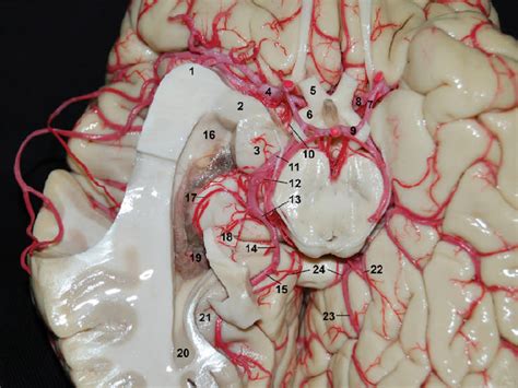 basal surface   brain neuroanatomy  neurosurgical atlas