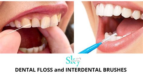 How to use Dental floss and Interdental brushes - Sky Dental Care