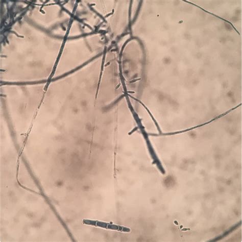 microscopic examination showed clublike macroconidia  microconidia