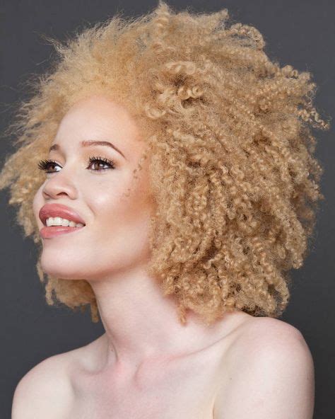 Albino Black Person On The Voice