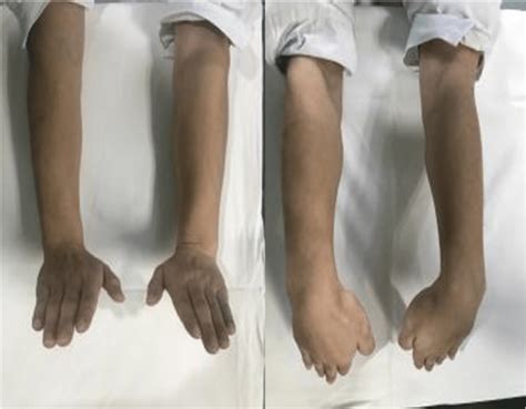 internal rotation  external rotation  scientific diagram