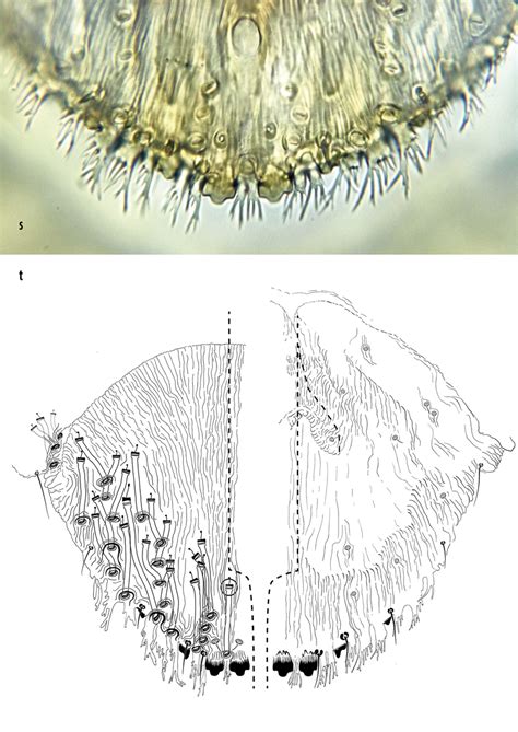 aspidiotus bornmuelleri lindinger margin  adult female pygidium