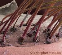 Demodex Folliculorum in EyeLashes ~ EyeLash Demodex Mites