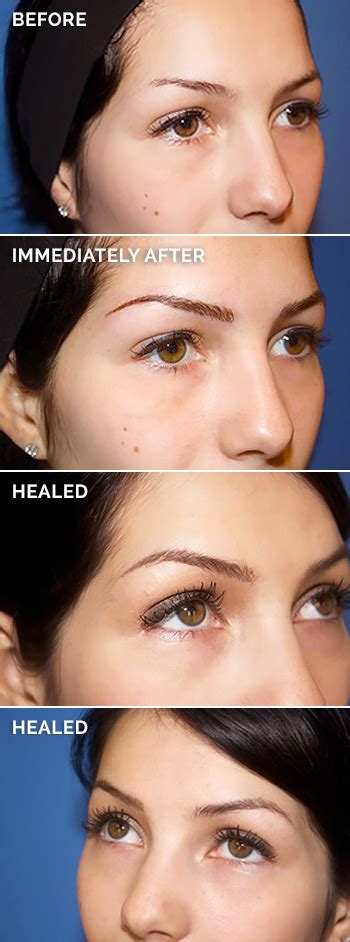 Permanent Makeup Eyebrows Before After And Healed - Bios Pics