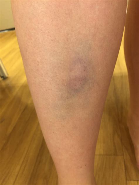 Reddit - Dive into anything