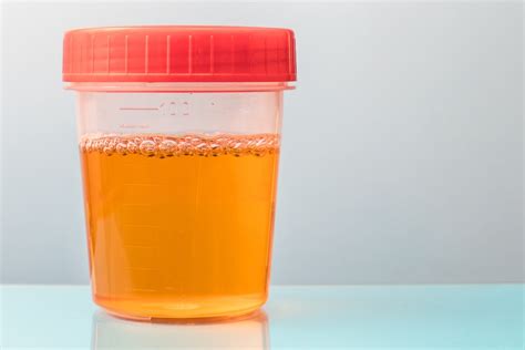 Causes of Orange Urine: Can One Be Cancer? » Scary Symptoms