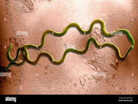 syphilis bacterium coloured transmission electron micrograph tem
