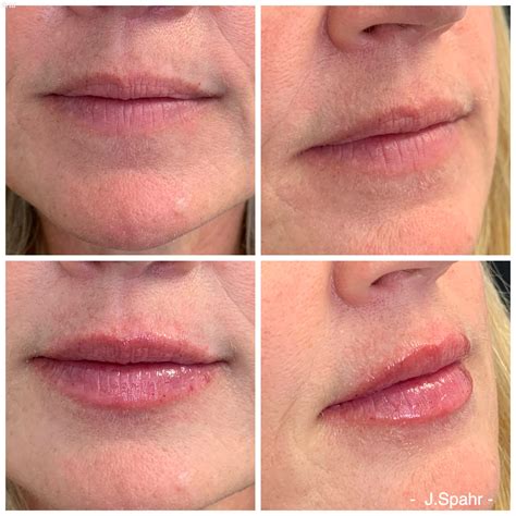 Murrieta Patch: Before & After Photos Will Astound You! Image 12