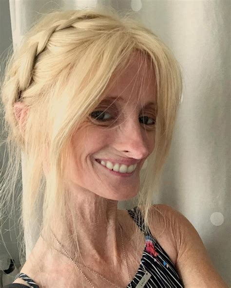 year  woman  oldest living survivor  rapid aging disease