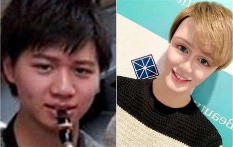 25 людей с неудачными пластическими операциями, которые зря легли под ...