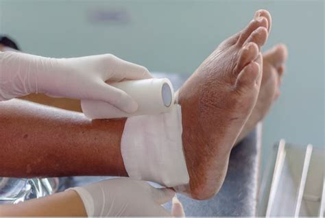 Ankle Gout - Causes, Symptoms, and Treatment in Nashville