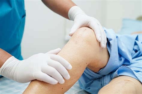Knee Replacements: What to Expect Before, During, and After Surgery