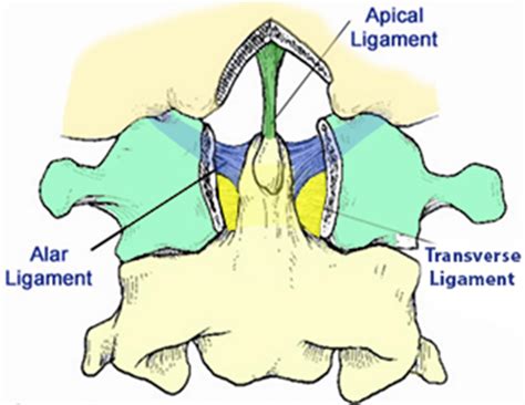 Atlas Fractures & Transverse Ligament Injuries - Spine - Orthobullets