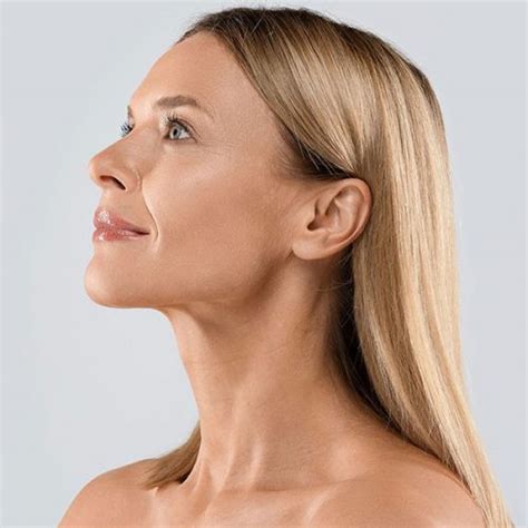 inmode treatment sydney evolution laser clinic