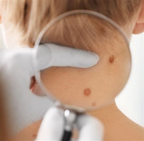 medical dermatology edmonton dermatology