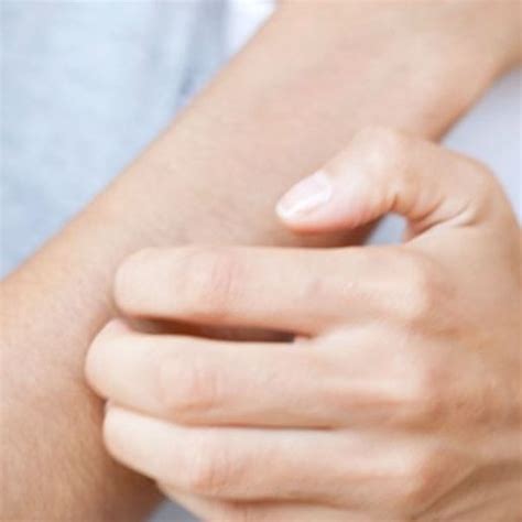 ketahui  penyebab gatal  kulit   meredakannya