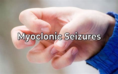 Myoclonic Seizures and Epilepsy Overview - EpilepsyU