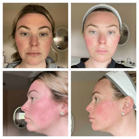 Nucelebs: Before & After Photos You Have To See! - nxe9di6