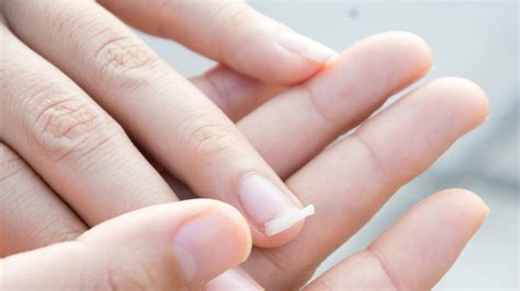 how to fix a nail tear