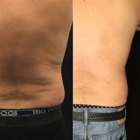 Is Nashville Body Rub Right For YOU? A Therapist's Honest Guide Image 8