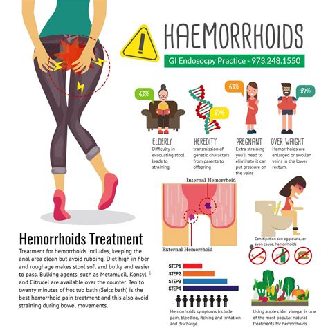 External hemorrhoids treatment pictures symptoms and causes – Artofit