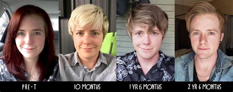 M/26/5'9" [145lbs > 145lbs = 0lbs] (28 months) Just an FTM Trans guy