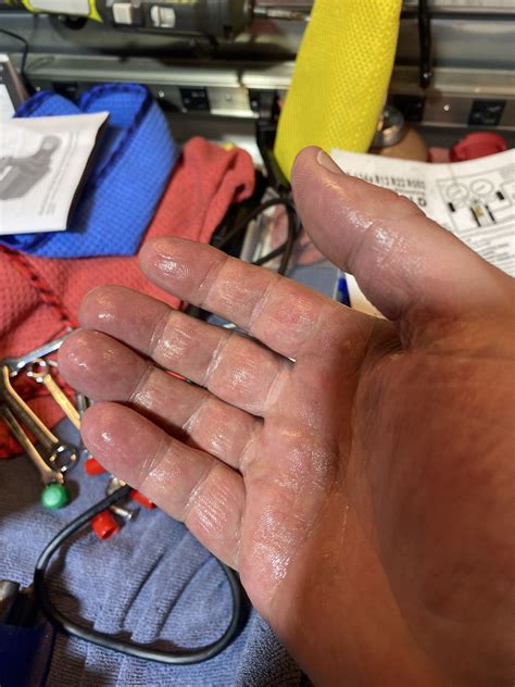 AC Compressor Oil? | Mercedes-Benz Forum